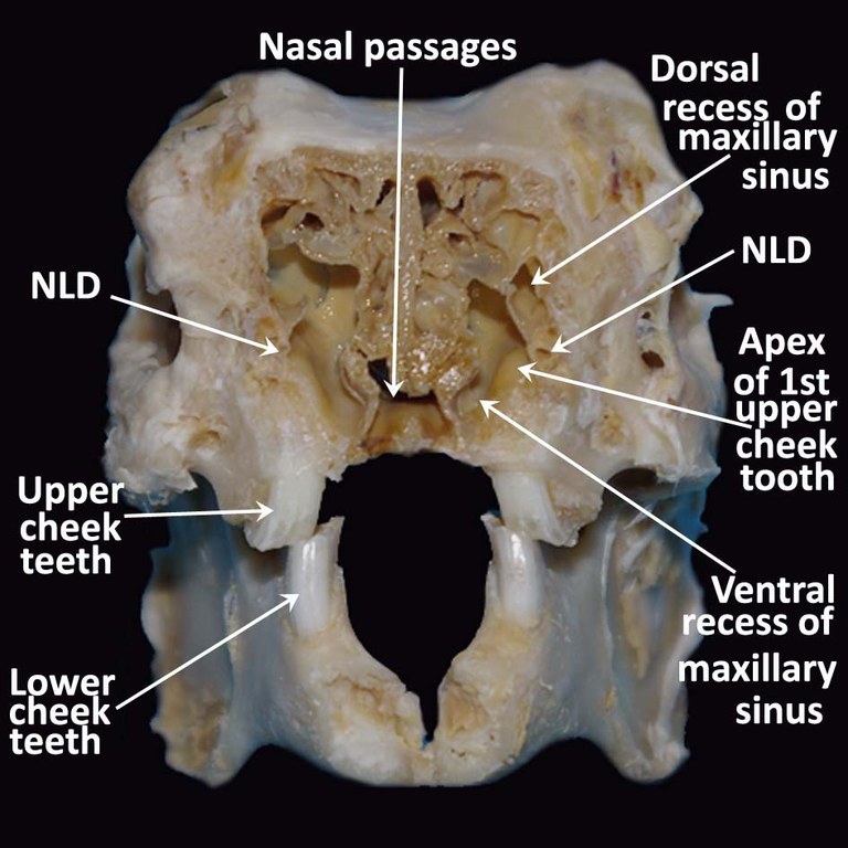 Transverse section through the skull (labelled)