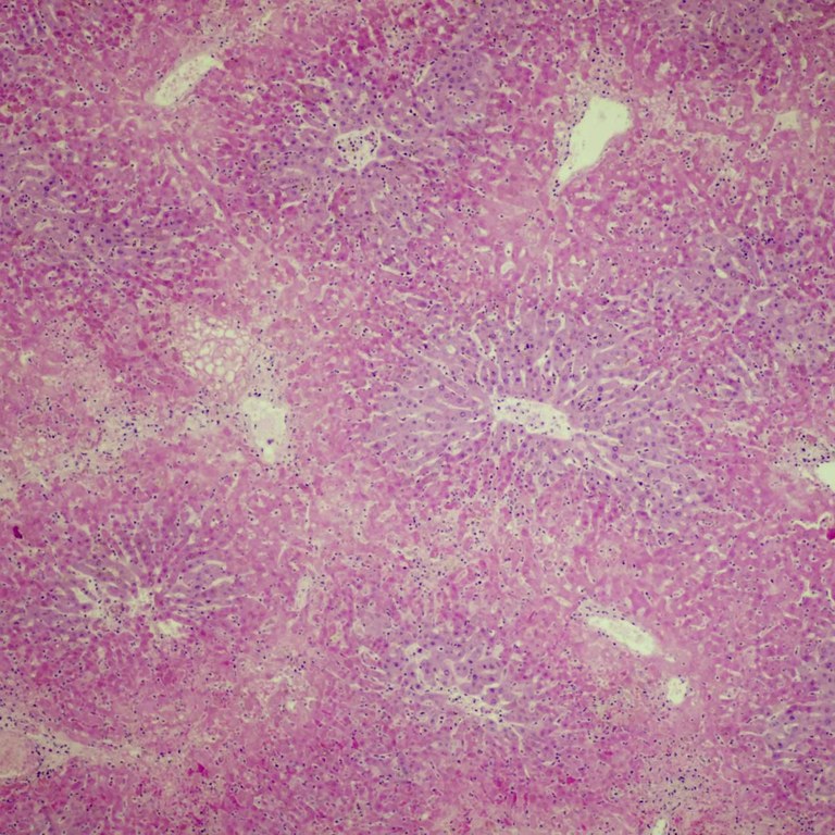 Hepatocellular necrosis due to RHDV2
