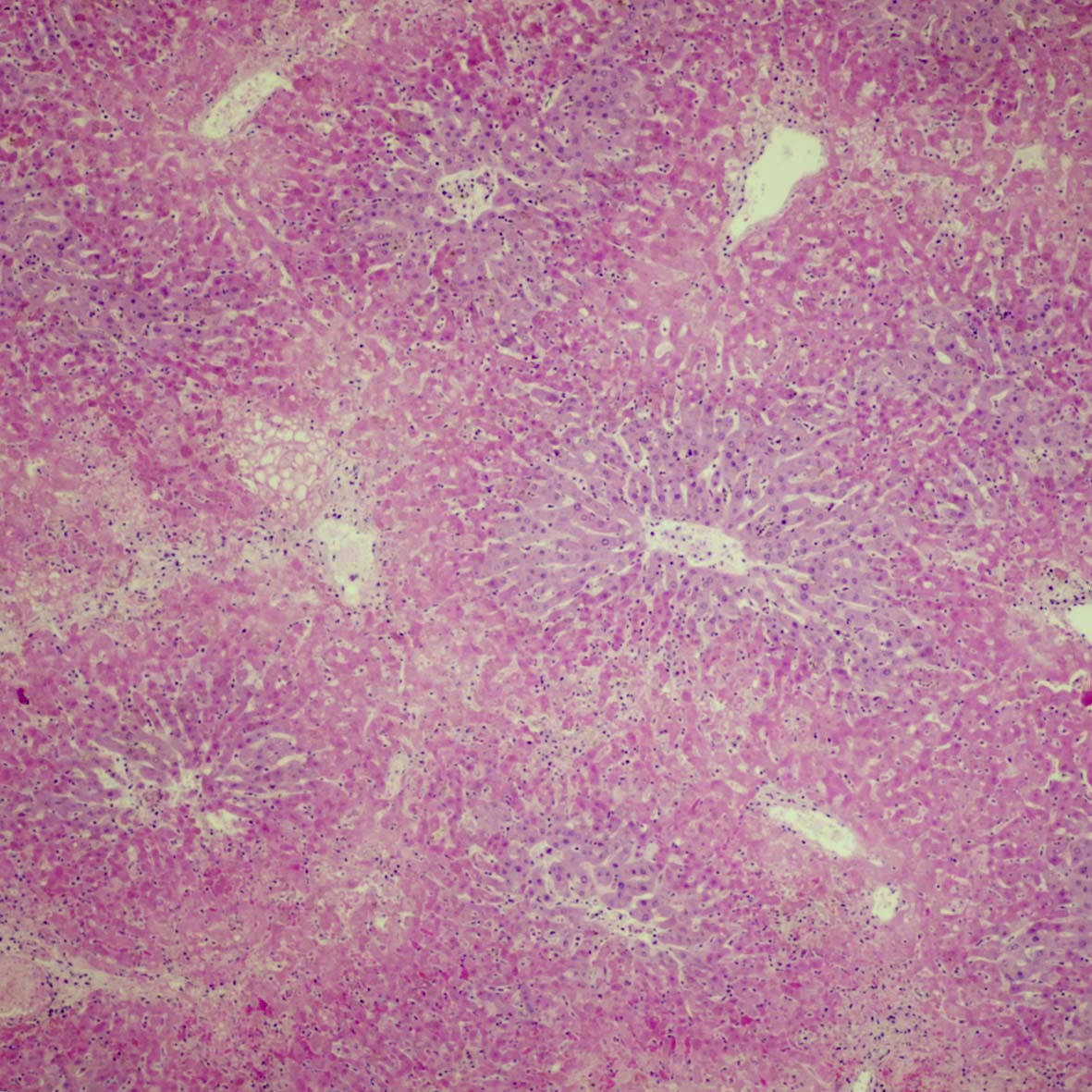 Hepatocellular necrosis due to RHDV2
