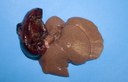 Liver lobe torsion