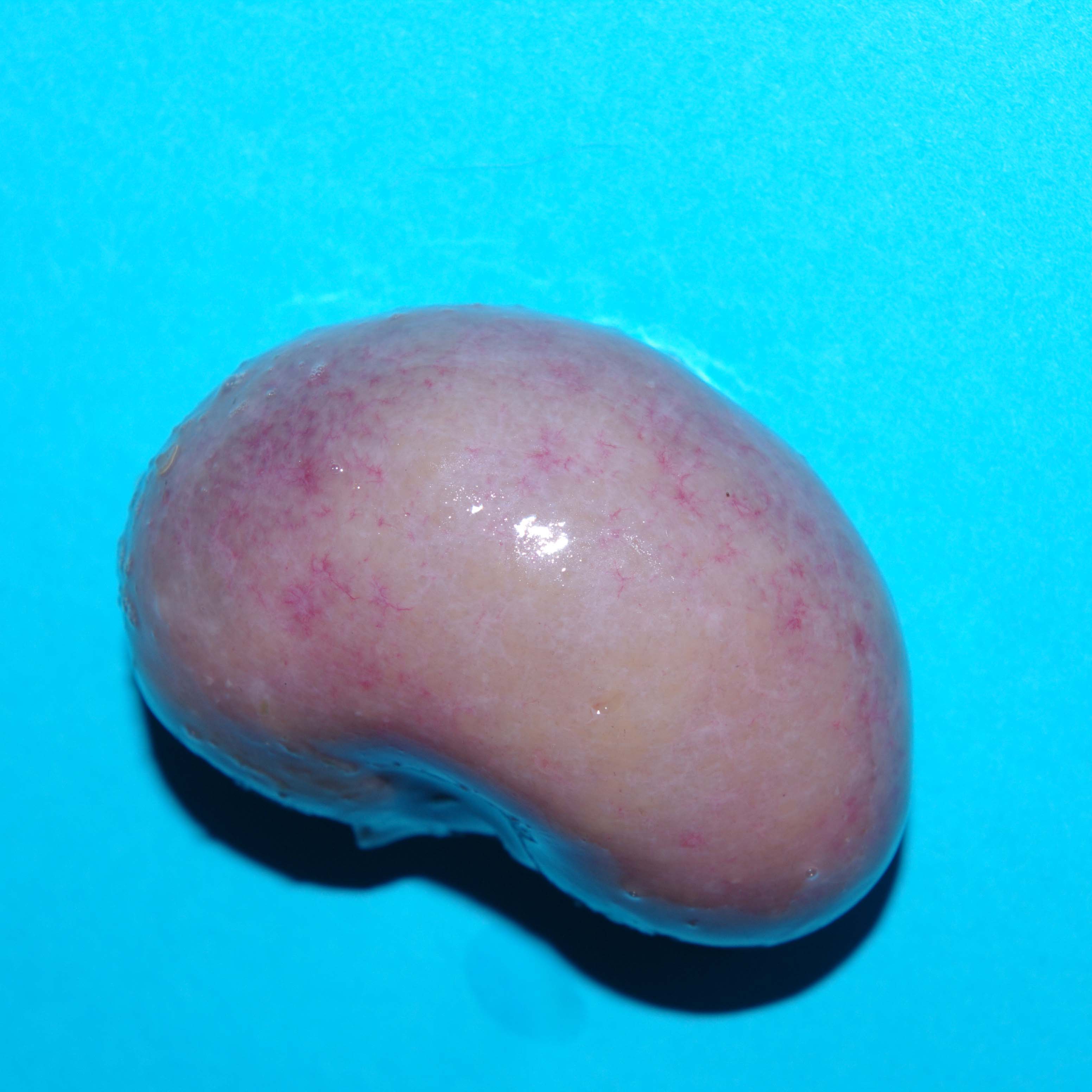 Pale kidney