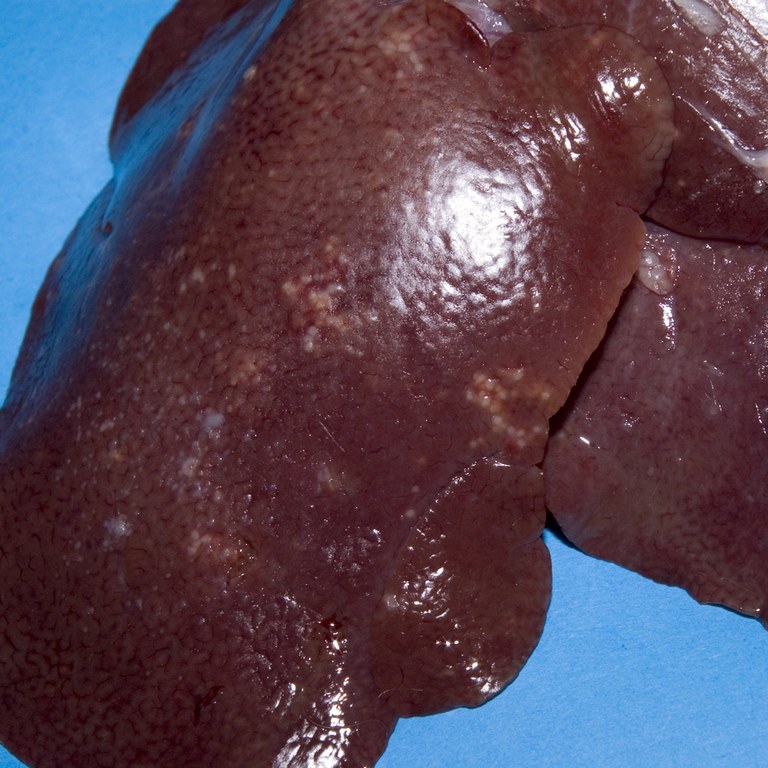 White spots in liver