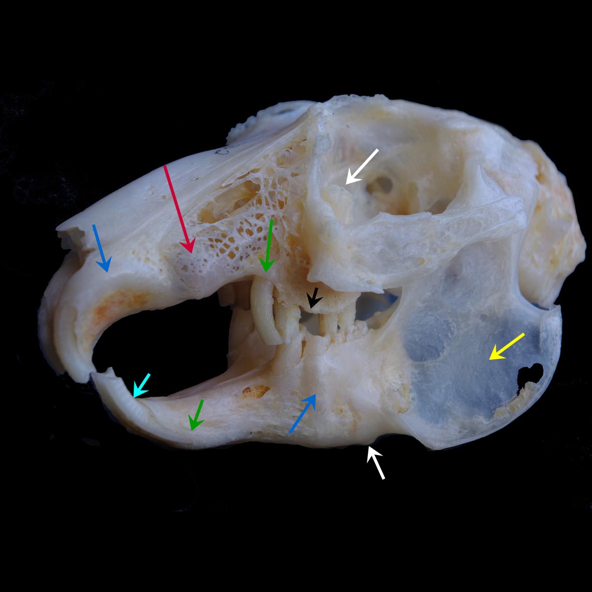 Annotated skull showing features of PSADD