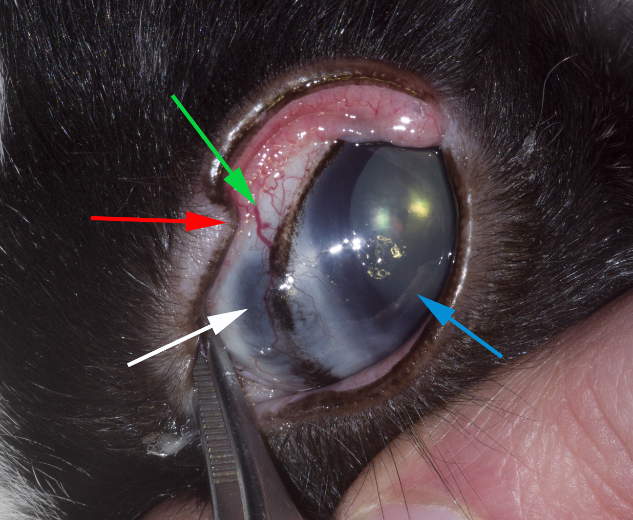 Arrows to abnormal areas of glaucomatous eye