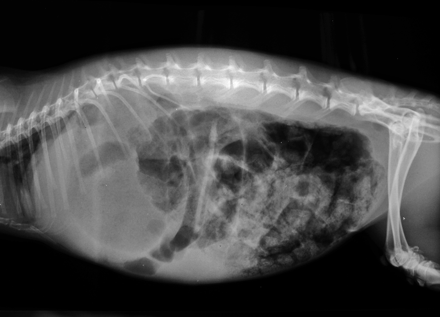 Mucoid enteropathy