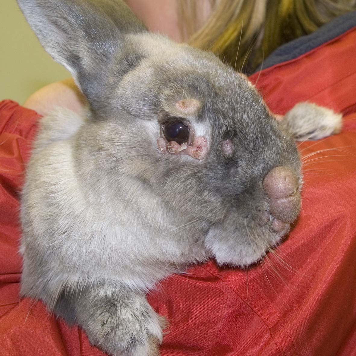 Myxomatosis in a case that recovered